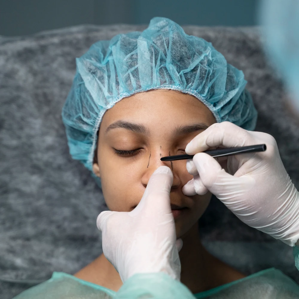 Rinoplastia funcional e estética